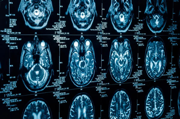 Un grupo de TAC escanea el cerebro humano — Foto de Stock