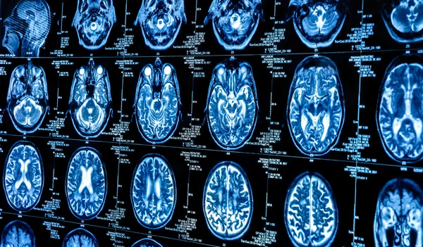Группа компьютерных томографов человеческого мозга — стоковое фото