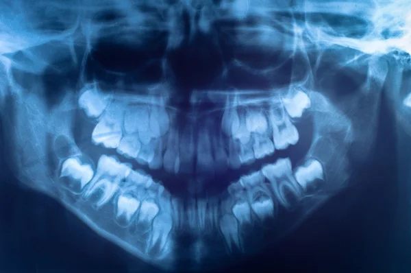 Insan kafatası closeup — Stok fotoğraf