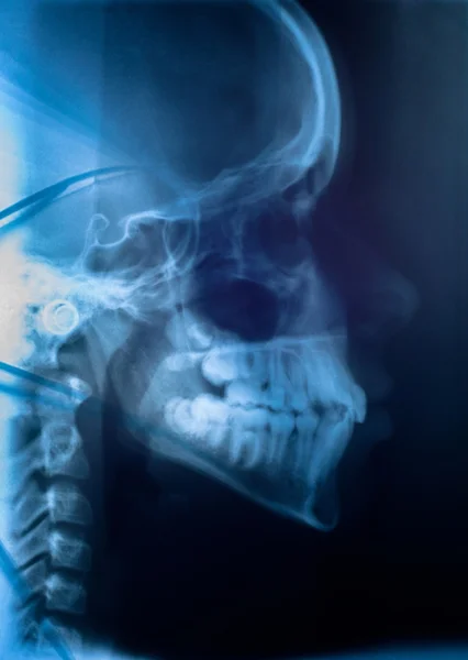 Medizinische Untersuchung des menschlichen Kopfes — Stockfoto