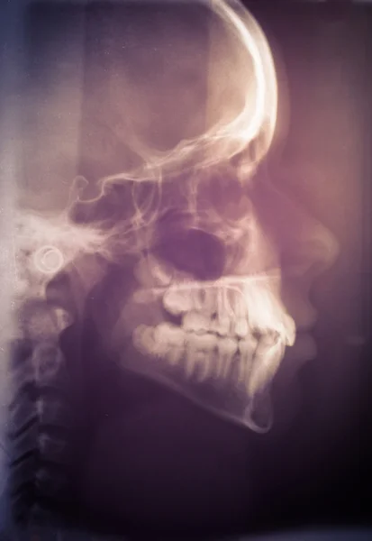 Human skull scan — Stock Photo, Image