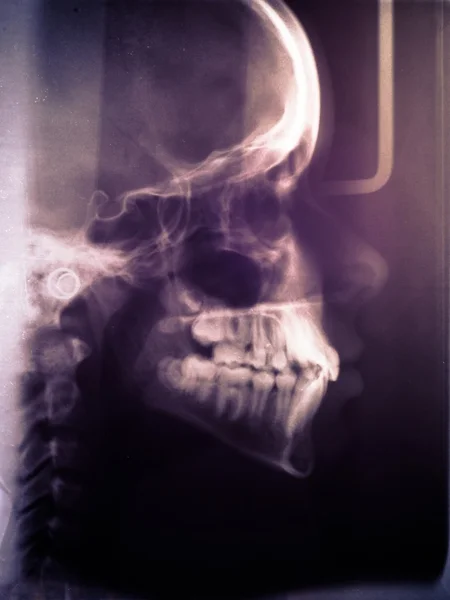 Human skull scan — Stock Photo, Image