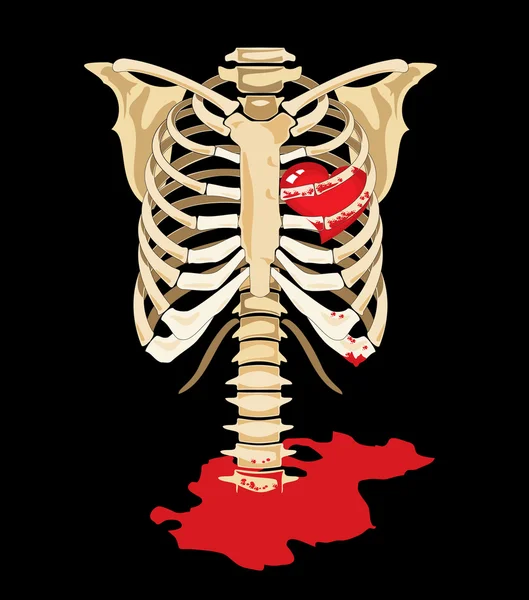 Vector. rood hart binnenkant skelet — Stockvector