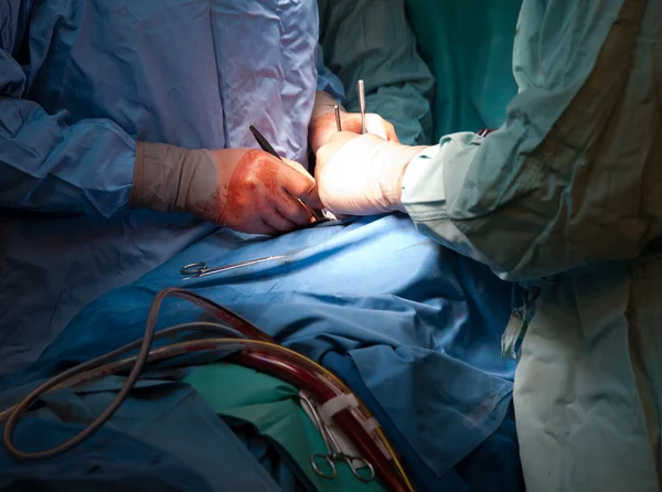 Surgeon hands during operation — Stock Photo, Image