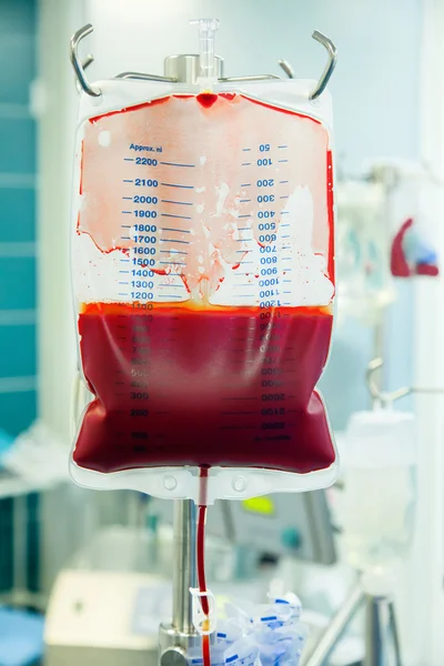 Trasfusione di sangue umano — Foto Stock