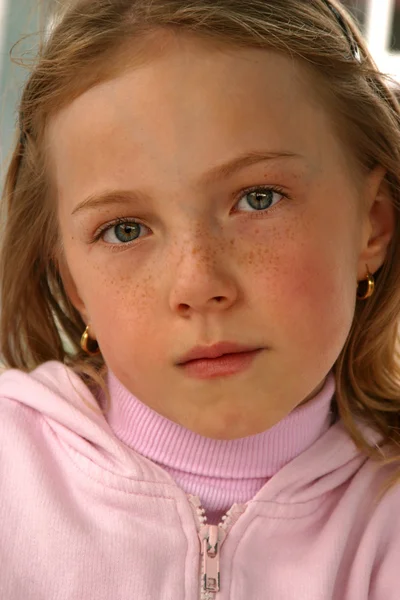 Freckled Face — Stock Photo, Image