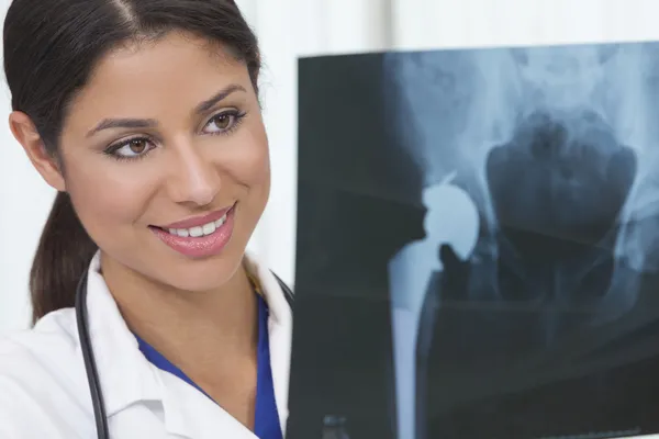 Vrouwelijke vrouw ziekenhuis arts met x-ray — Stockfoto