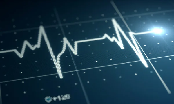 Elektrokardiogramm — Stockfoto