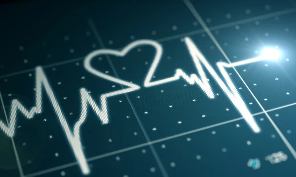 Srdeční monitor — Stock fotografie