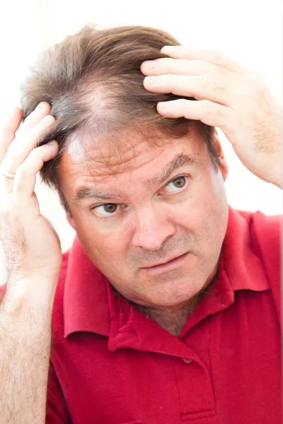 Άνθρωπος ανησυχούν για balding — Φωτογραφία Αρχείου