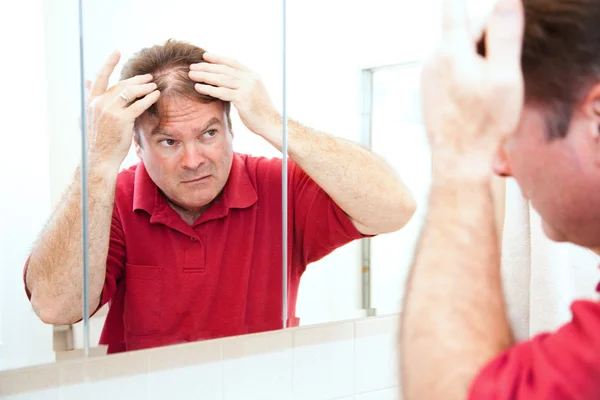Thinning Hair in Middle Age — Stock Photo, Image