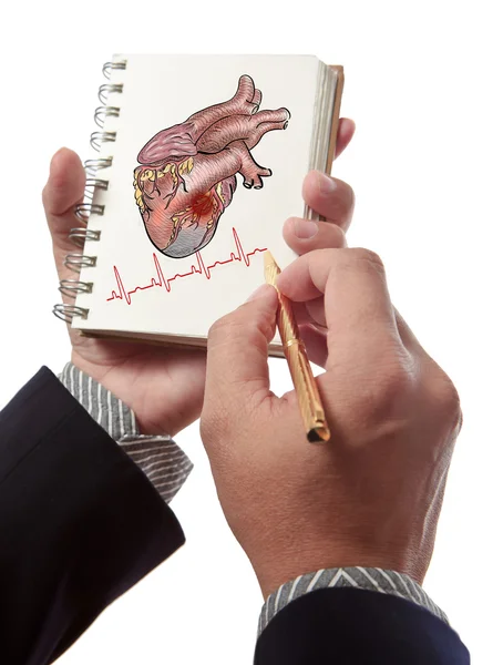 Doctor dibujando corazón Ataque y latidos cardíacos cardiograma — Foto de Stock