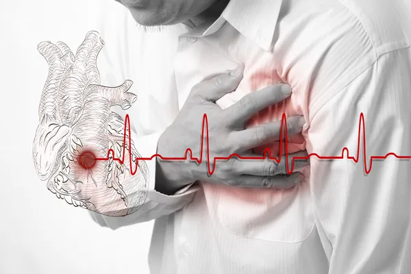 Серцева атака і серцебиття кардіограма фону — стокове фото