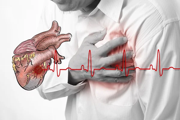 Καρδιακή προσβολή και καρδιά κτυπά καρδιογράφημα φόντο — Φωτογραφία Αρχείου