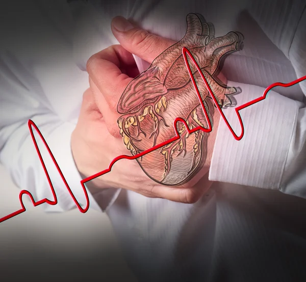 Ataque cardíaco y latidos cardíacos Fondo del cardiograma —  Fotos de Stock