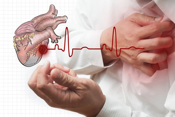 Szívroham és a szív dobog cardiogram háttér — Stock Fotó