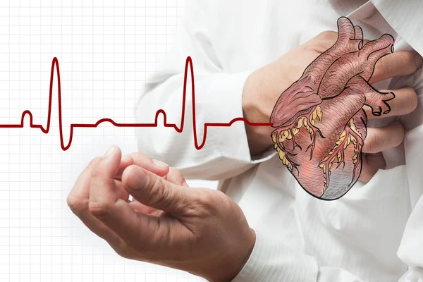 Сердечный приступ и сердцебиение на фоне кардиограммы — стоковое фото