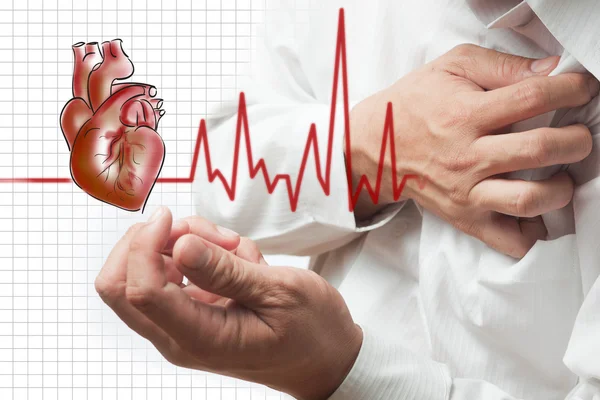 Kalp krizi ve kalp atım kardiyogram arka plan — Stok fotoğraf