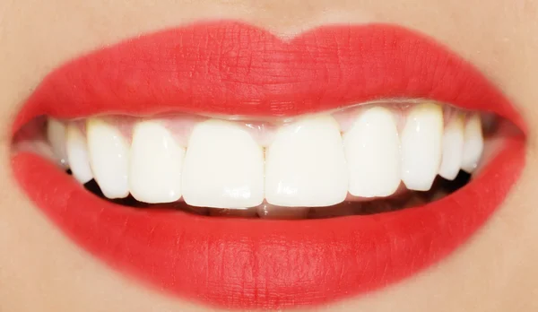 Lachende vrouw glimlach met grote tanden — Stockfoto