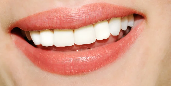 Smějící se ženu úsměv s velké zuby — Stock fotografie