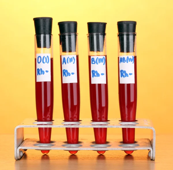Tubos de ensaio com sangue sobre mesa de madeira sobre fundo amarelo — Fotografia de Stock
