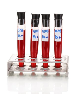 Test-tubes with blood isolated on white clipart