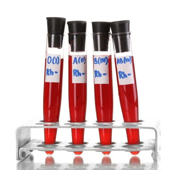 Test-buizen met bloed geïsoleerd op wit — Stockfoto