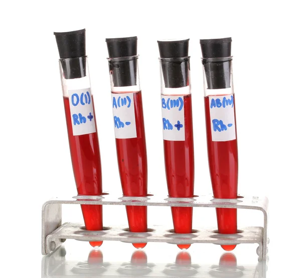Test-buizen met bloed geïsoleerd op wit — Stockfoto