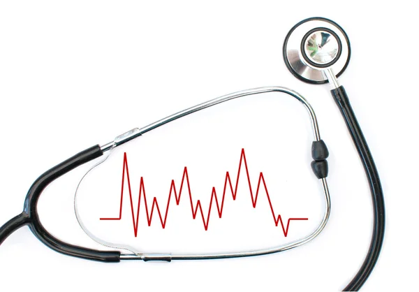Grafico del battito cardiaco e stetoscopio — Foto Stock