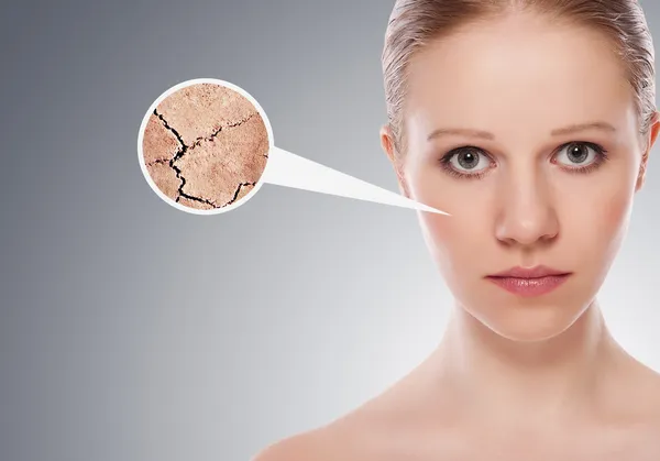 Koncepcja efekty kosmetyczne, leczenie i Pielęgnacja. twarz y — Zdjęcie stockowe