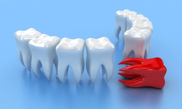 Los dientes. — Foto de Stock