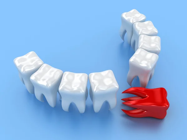 Los dientes. — Foto de Stock