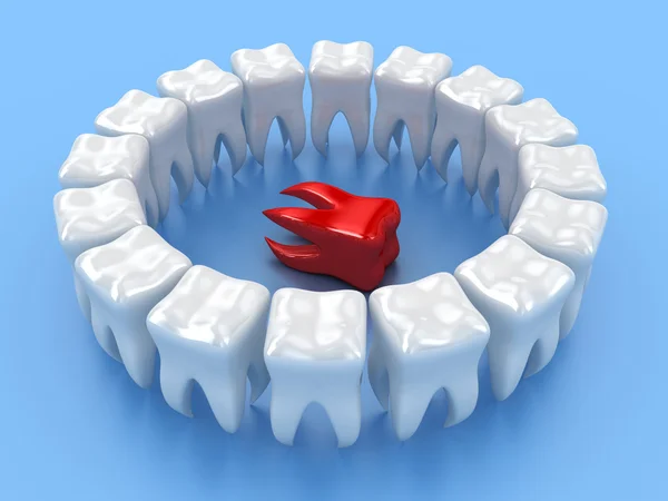 Dişler — Stok fotoğraf