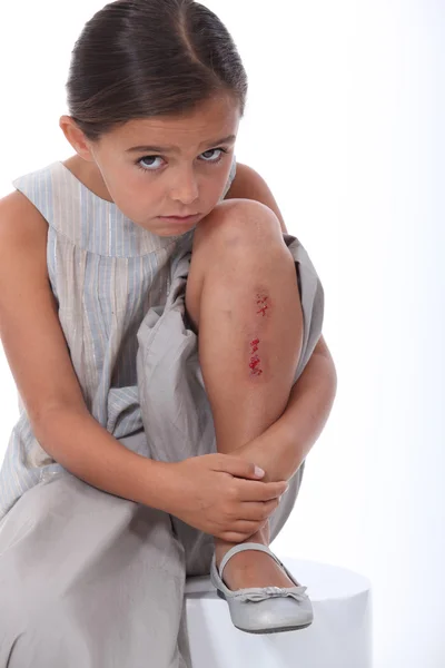 Młoda dziewczyna z nogą rannych — Zdjęcie stockowe