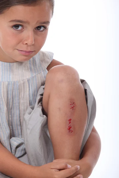Girl with a grazed leg — Stock Photo, Image