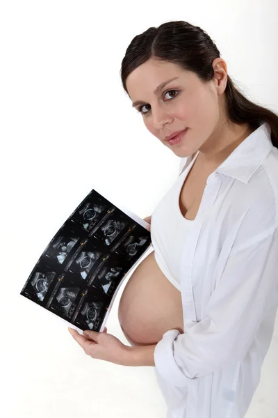 Gravid kvinna med scan — Stockfoto