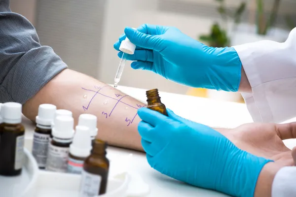 Skin prick allergy test — Stock Photo, Image