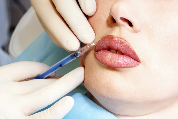 Inyección cosmética en los labios femeninos Imagen de archivo