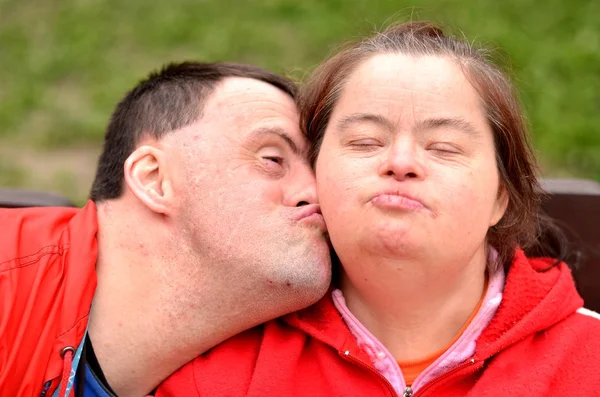 Down-szindróma szerelmes pár — Stock Fotó