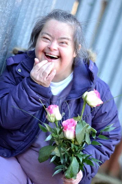Mujer con síndrome de Down — Foto de Stock