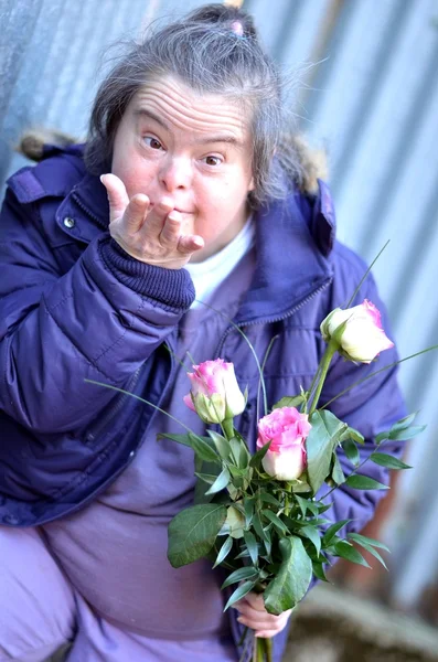 Frau mit Down-Syndrom — Stockfoto
