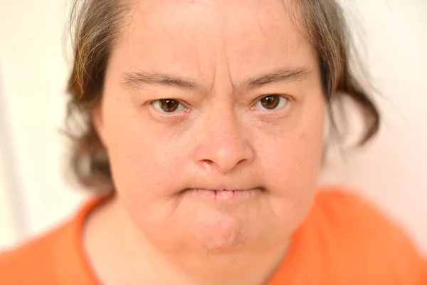 Жінка з синдромом Дауна — стокове фото