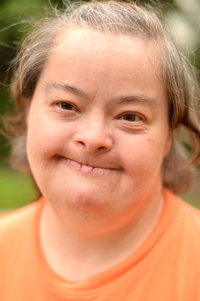 Kobieta z zespołem Downa — Zdjęcie stockowe
