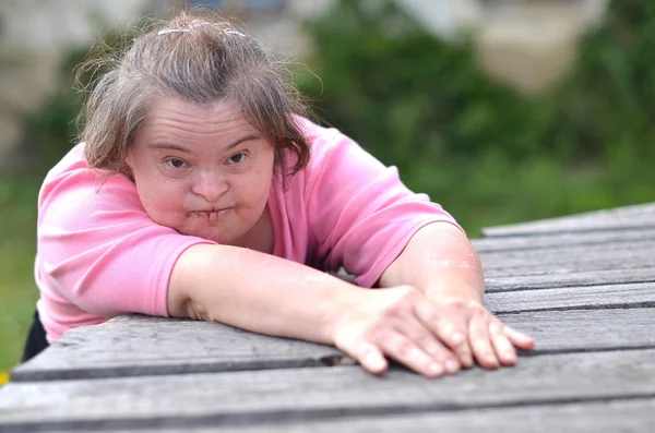 Kobieta z zespołem Downa — Zdjęcie stockowe