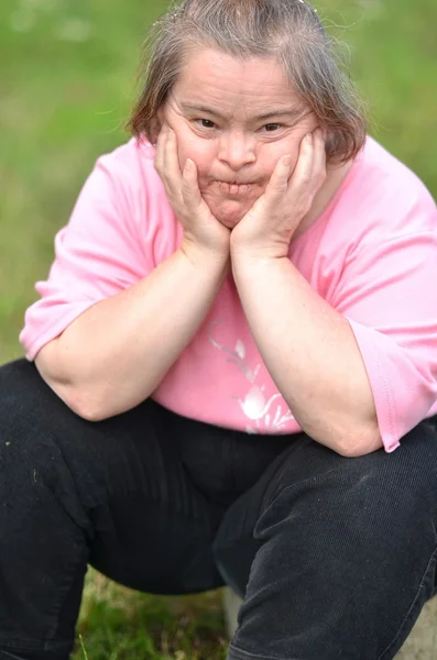 Mulher com síndrome de down — Fotografia de Stock