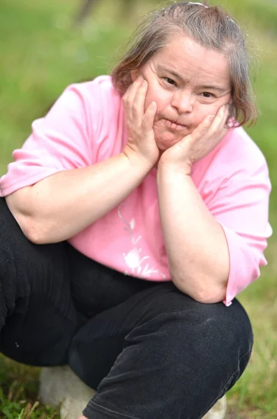 Žena s Downovým syndromem — Stock fotografie