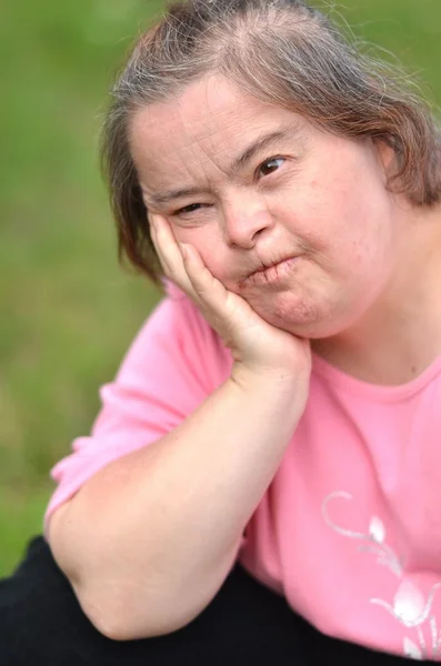 Donna con sindrome di Down — Foto Stock