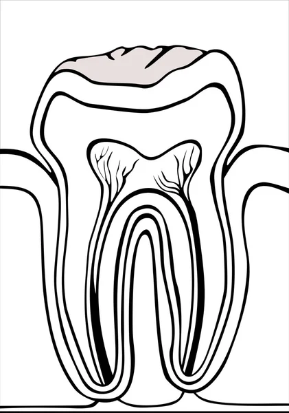 Зуб . — стоковий вектор