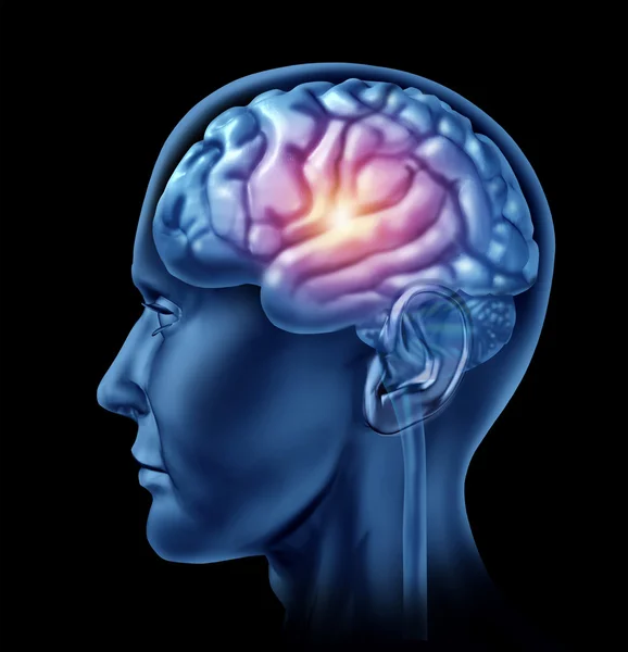 Inteligencja aktywności mózgu — Zdjęcie stockowe