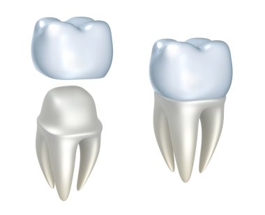 Dental crowns and tooth, isolated on white clipart